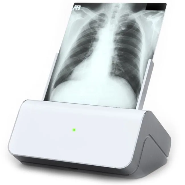 Оцифровщик-сканер рентгеновских пленок Rayscan Plus, фото 1