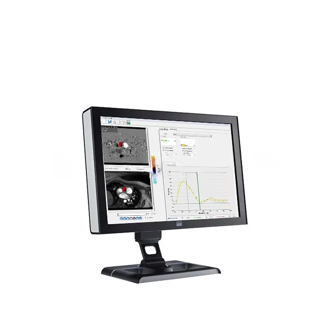 ПО для магнитно-резонансного анализа кровотока Esaote CAAS MR Flow, фото 3