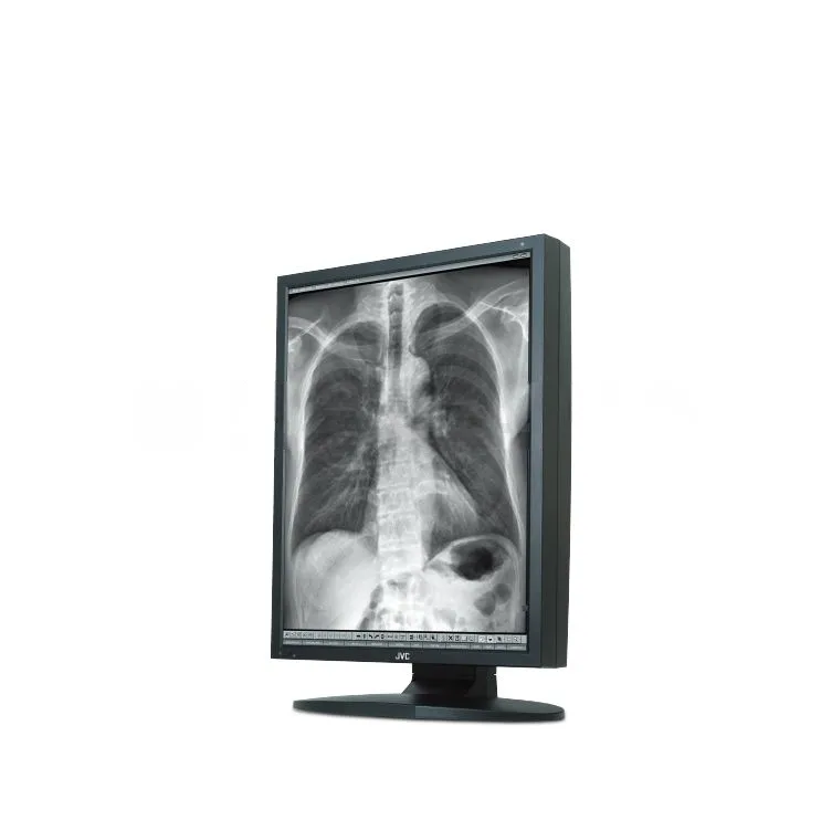 Медицинский монитор JVC MS35i2, фото 1