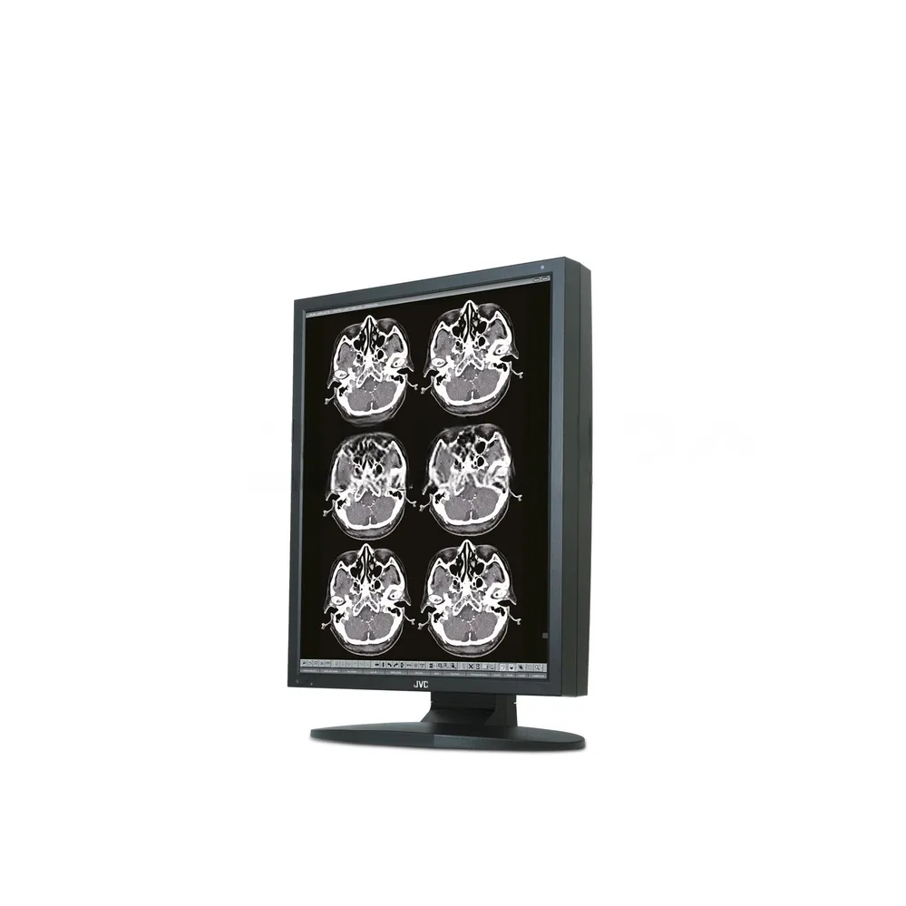 Медицинский монитор JVC MS25i2, фото 1