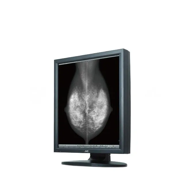 Медицинский монитор JVC MS55i2 plus, фото 1