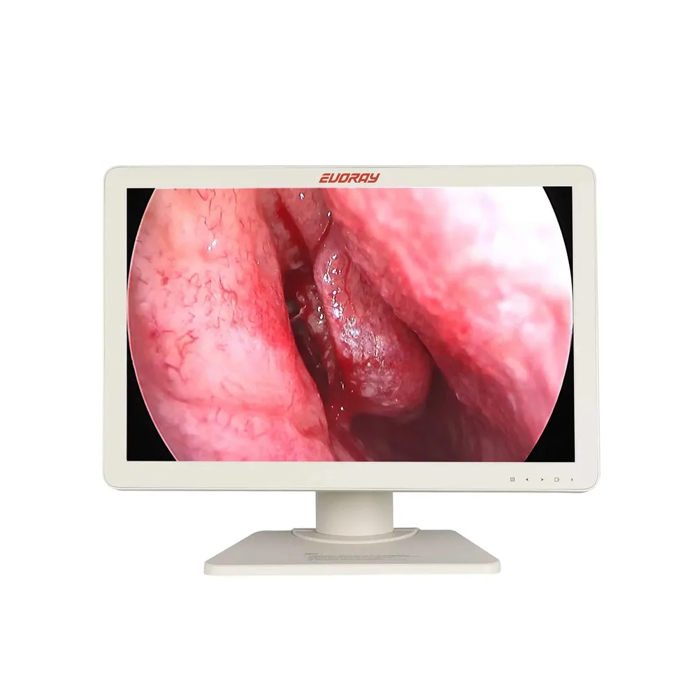 Монитор 24” Full HD эндоскопический-хирургический EVORAY Е2421, фото 1