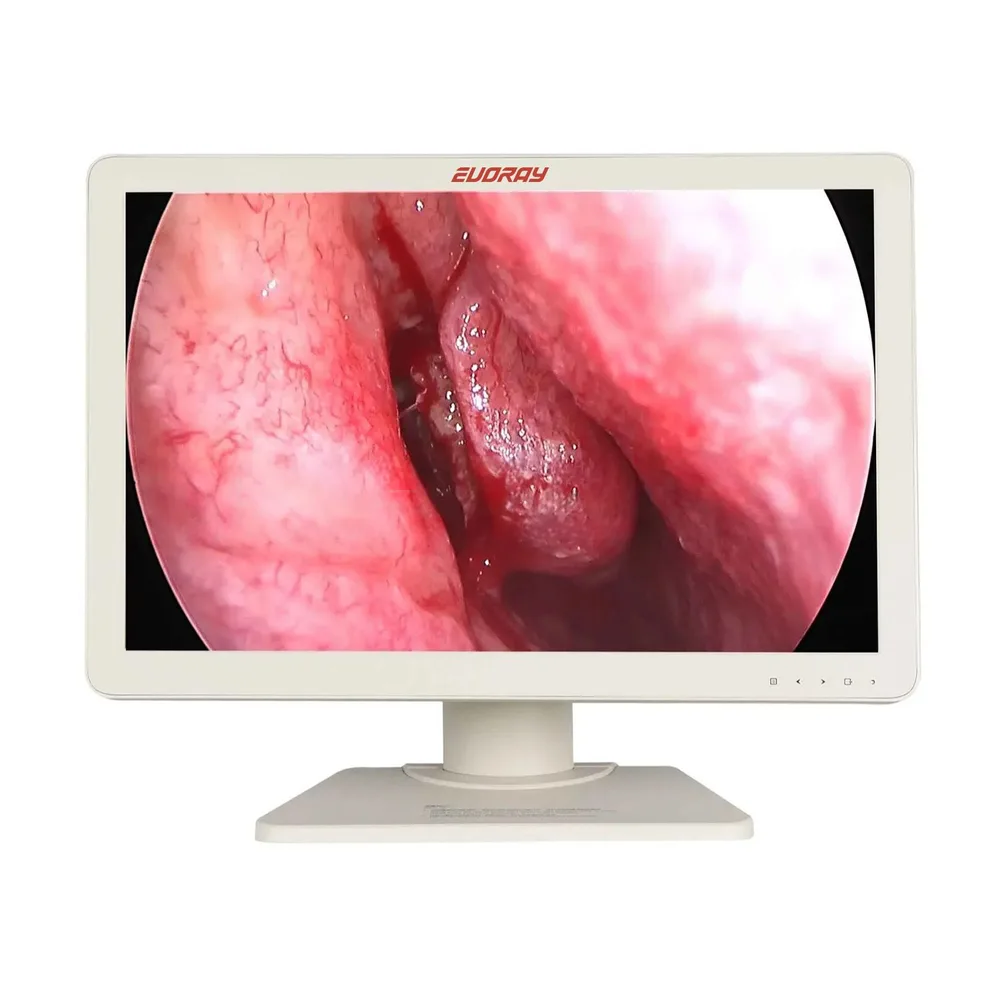 Монитор 27” Full HD эндоскопический-хирургический EVORAY S271P, фото 1
