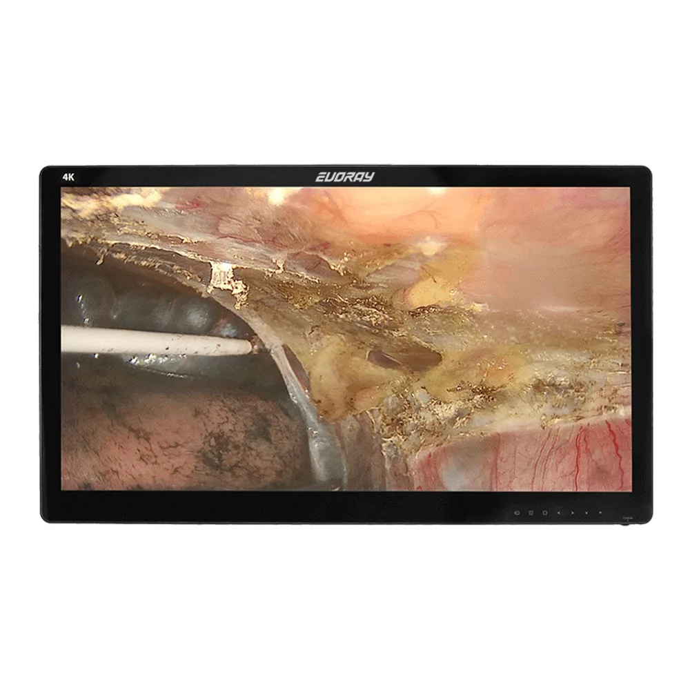 Монитор 32" 4K эндоскопический-хирургический EVORAY S3281P, фото 1