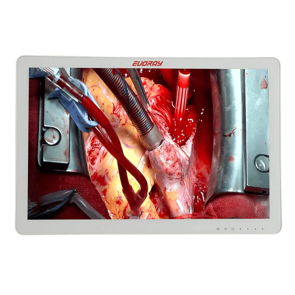 Монитор 32" Full HD эндоскопический-хирургический EVORAY S3221P, фото 1