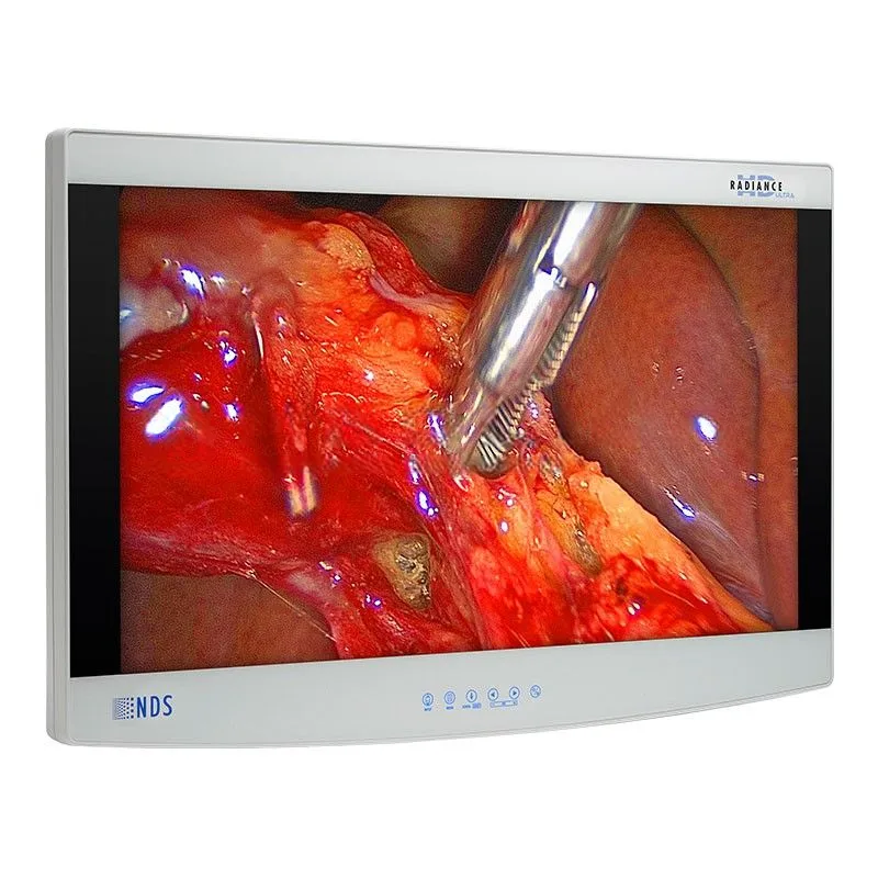 Монитор NDS Radiance Ultra 27", фото 2