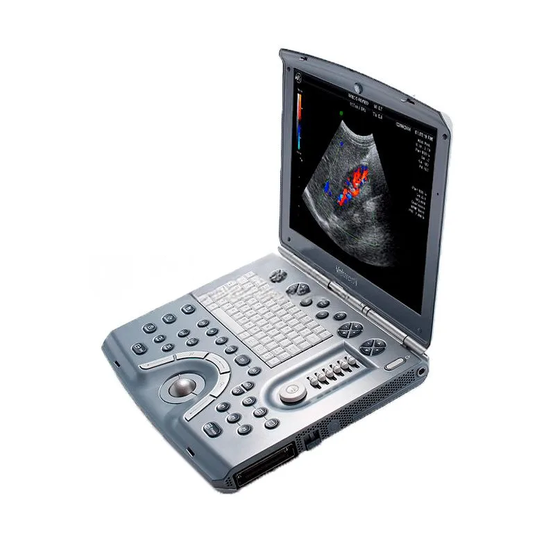 Портативный ультразвуковой сканер GE Healthcare Voluson I, фото 3