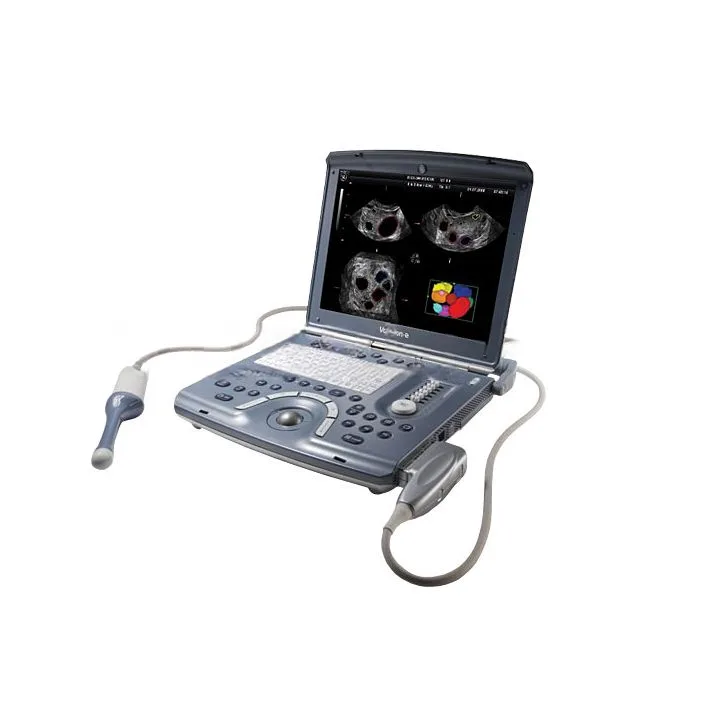 Портативный ультразвуковой аппарат GE Healthcare Voluson E, фото 1