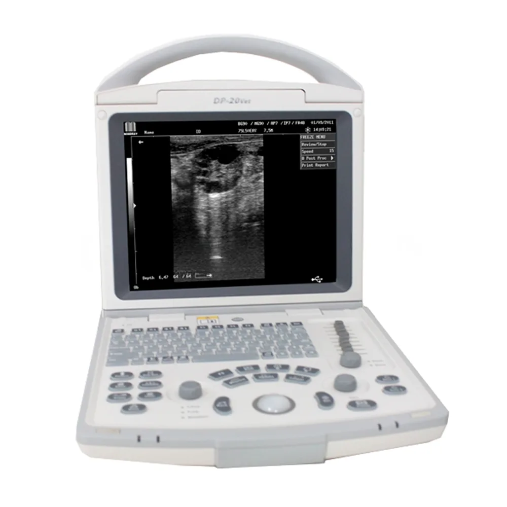 УЗИ система Mindray DP-20, фото 2