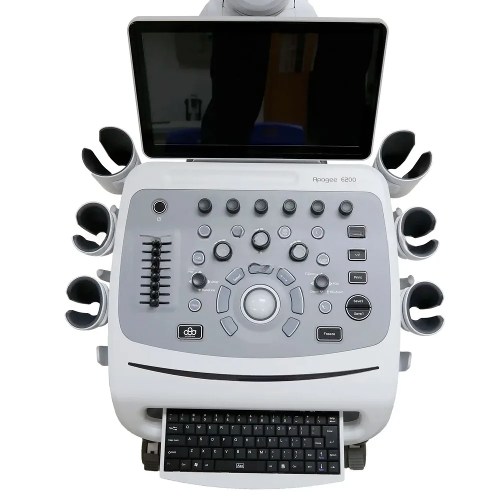УЗИ аппарат SIUI Apogee 6200, фото 2