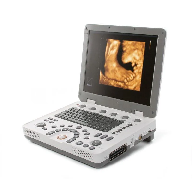 УЗИ аппарат Samsung MySono U6, фото 1