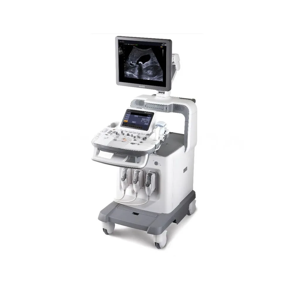 УЗИ сканер Samsung Accuvix XG, фото 1