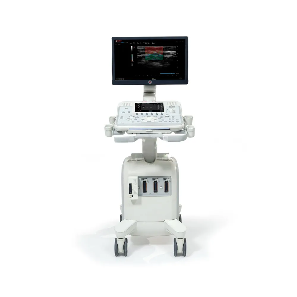 УЗИ аппарат Esaote MyLab X6, фото 1