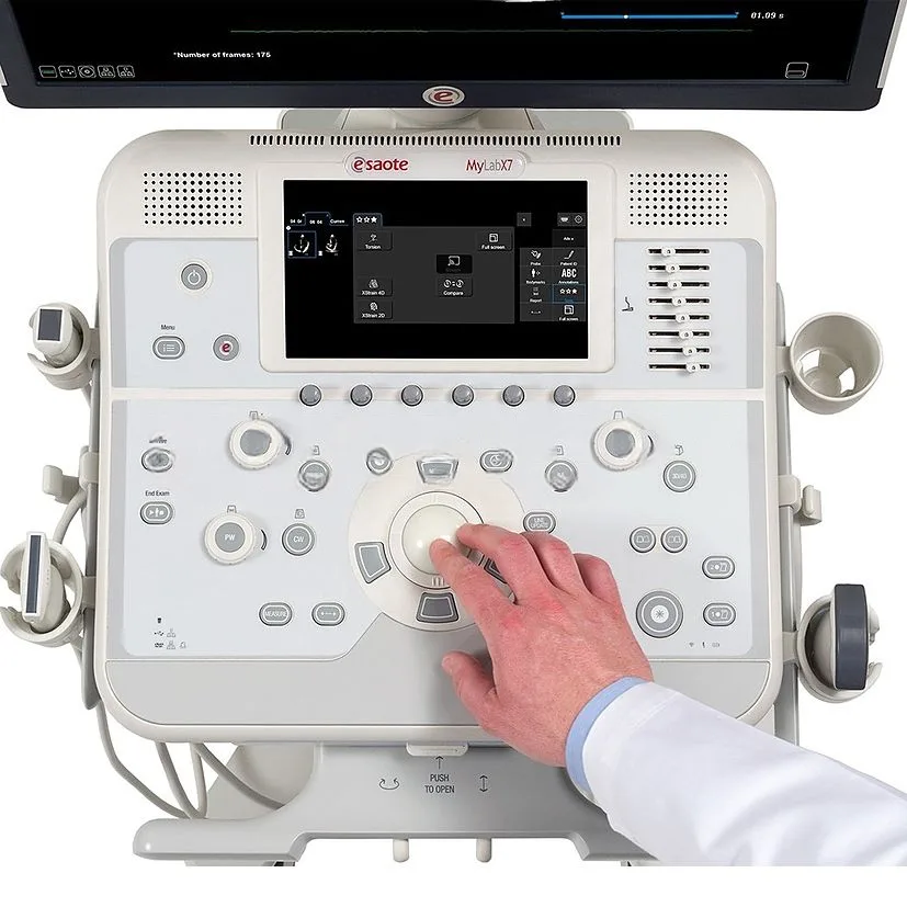 УЗИ аппарат Esaote MyLab X7, фото 3
