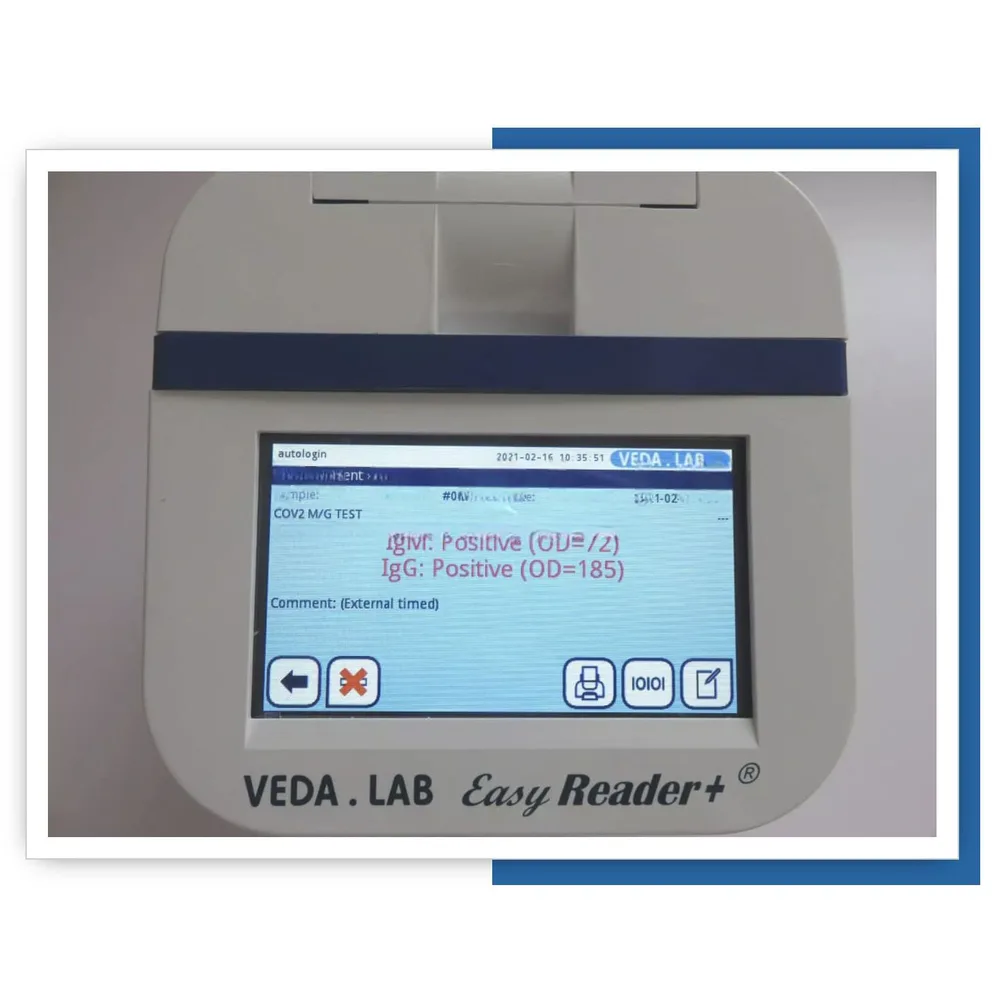 Экспресс-анализатор иммунохроматографический Easy Reader+, фото 3