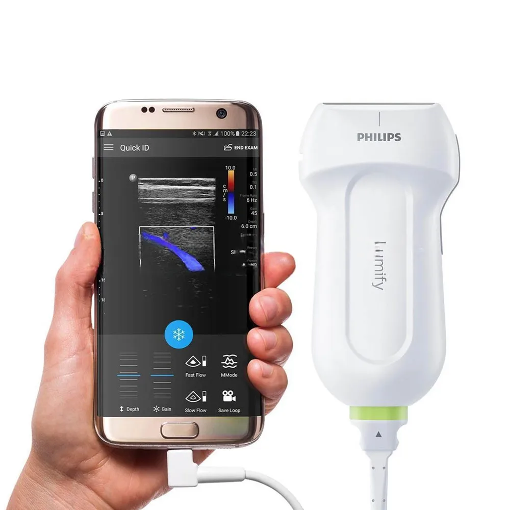Мобильная ультразвуковая система Philips Lumify, фото 1