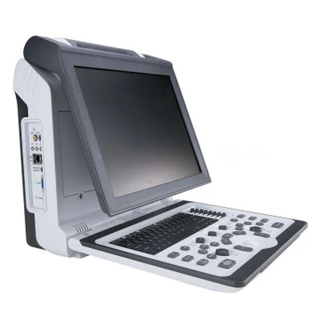 Портативный ультразвуковой сканер SIUI CTS 7700 2 датчика, фото 3