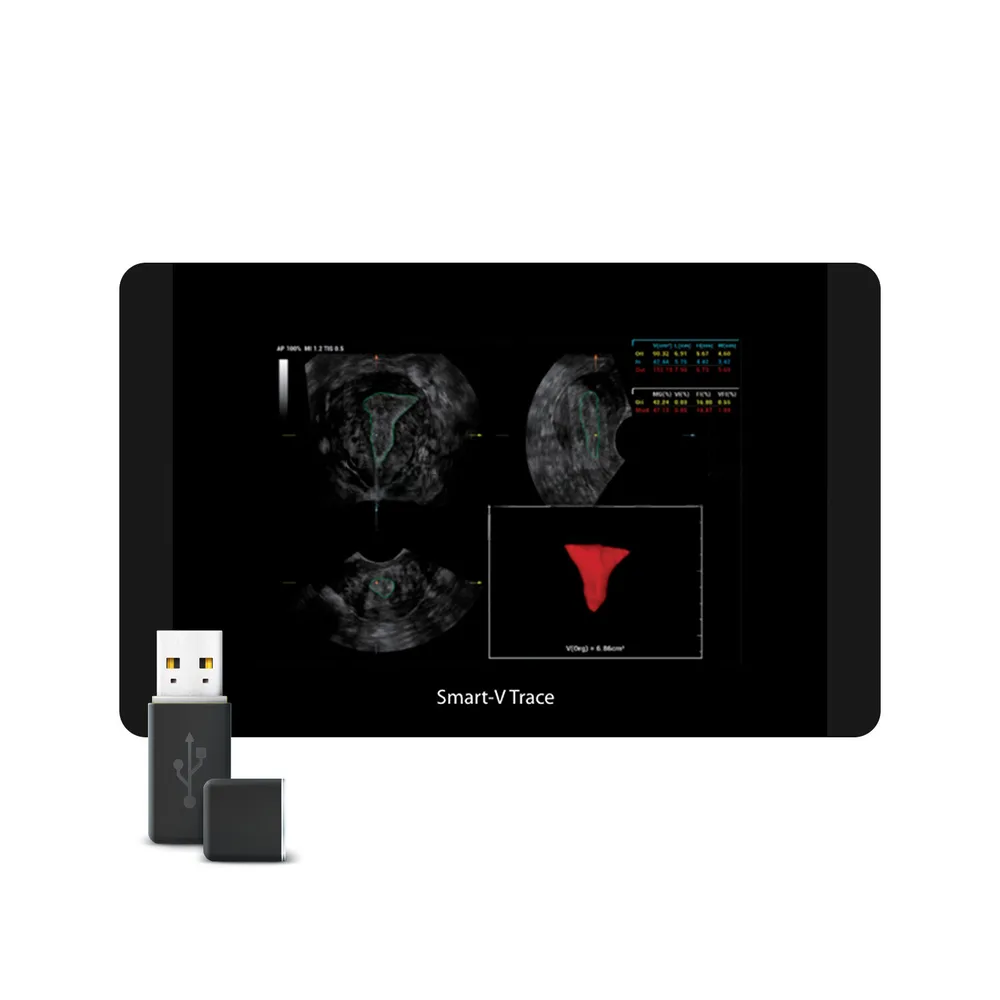 Smart V Trace, фото 1