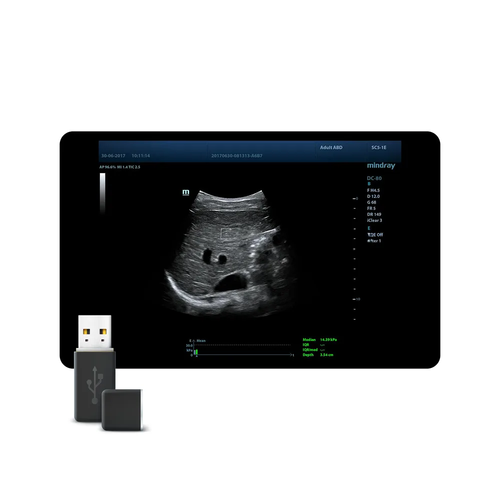 STQ (Sound Touch Quantification), фото 1