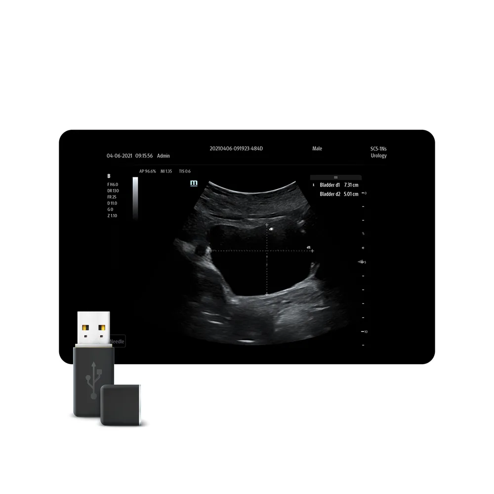 Smart Bladder, фото 1