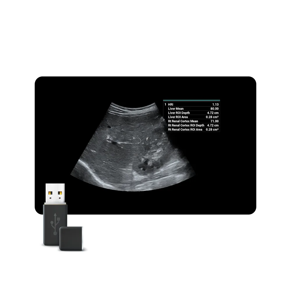 Smart HRI, фото 1