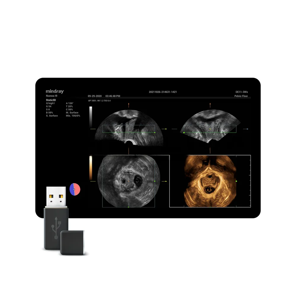 Smart Pelvic, фото 1