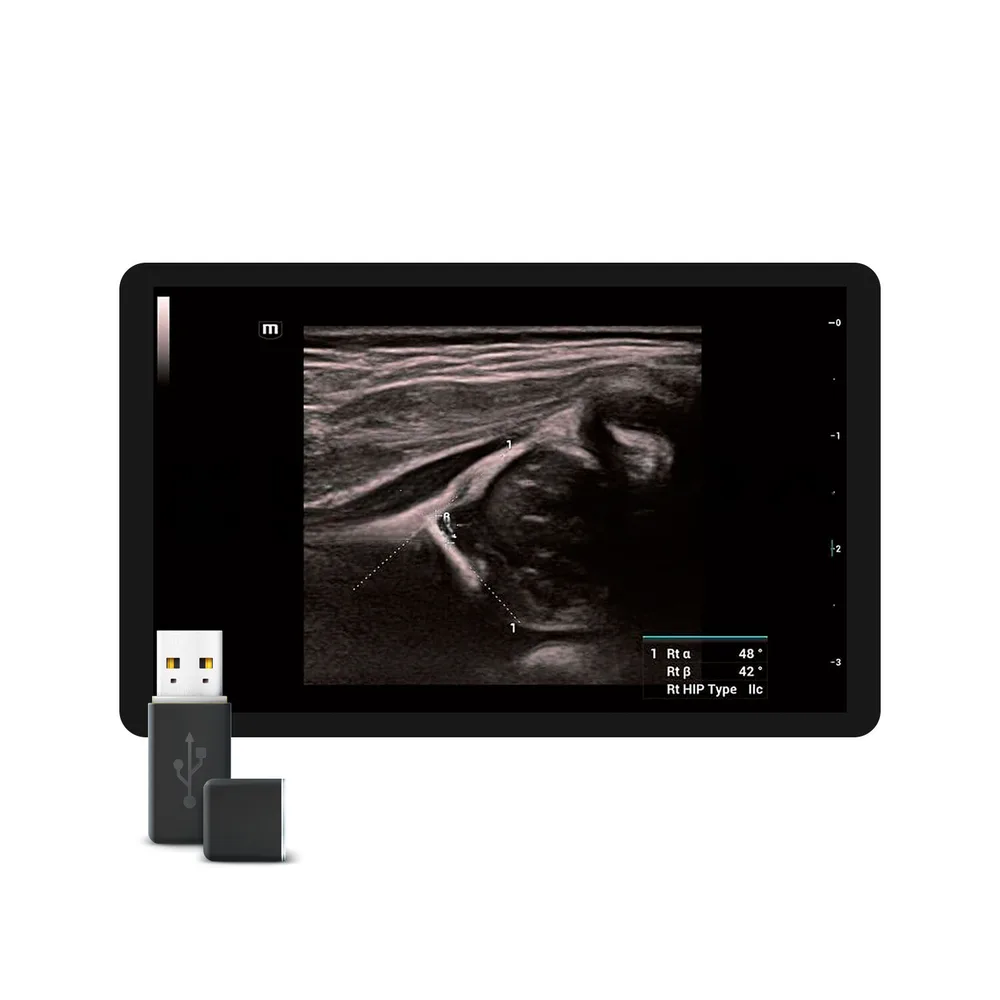Smart Hip, фото 1