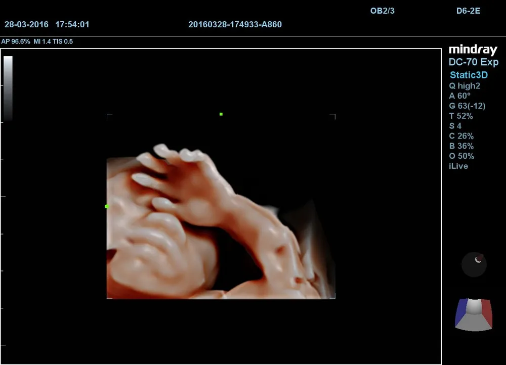 iLive™, фото 3