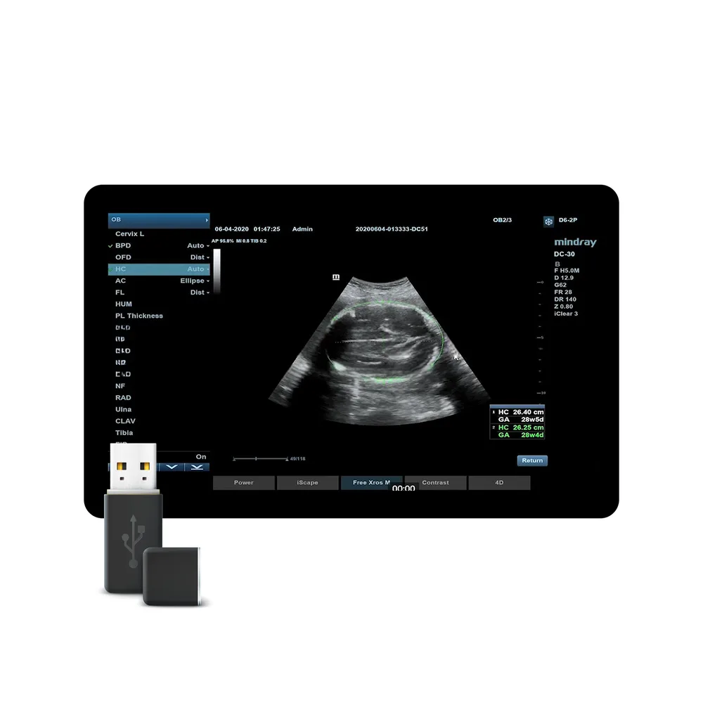 Smart OB, фото 1