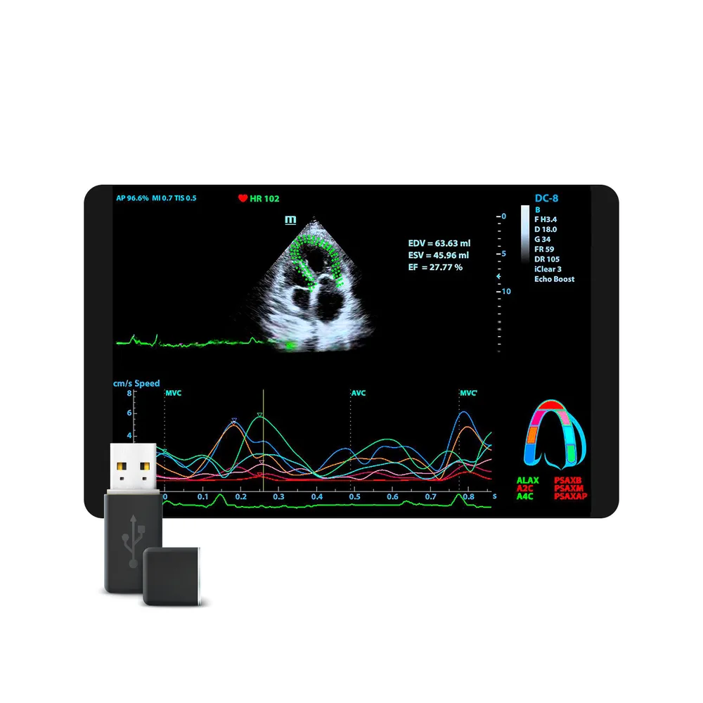 Tissue Tracking QA, фото 1