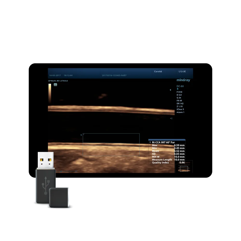 Auto IMT Package, фото 1