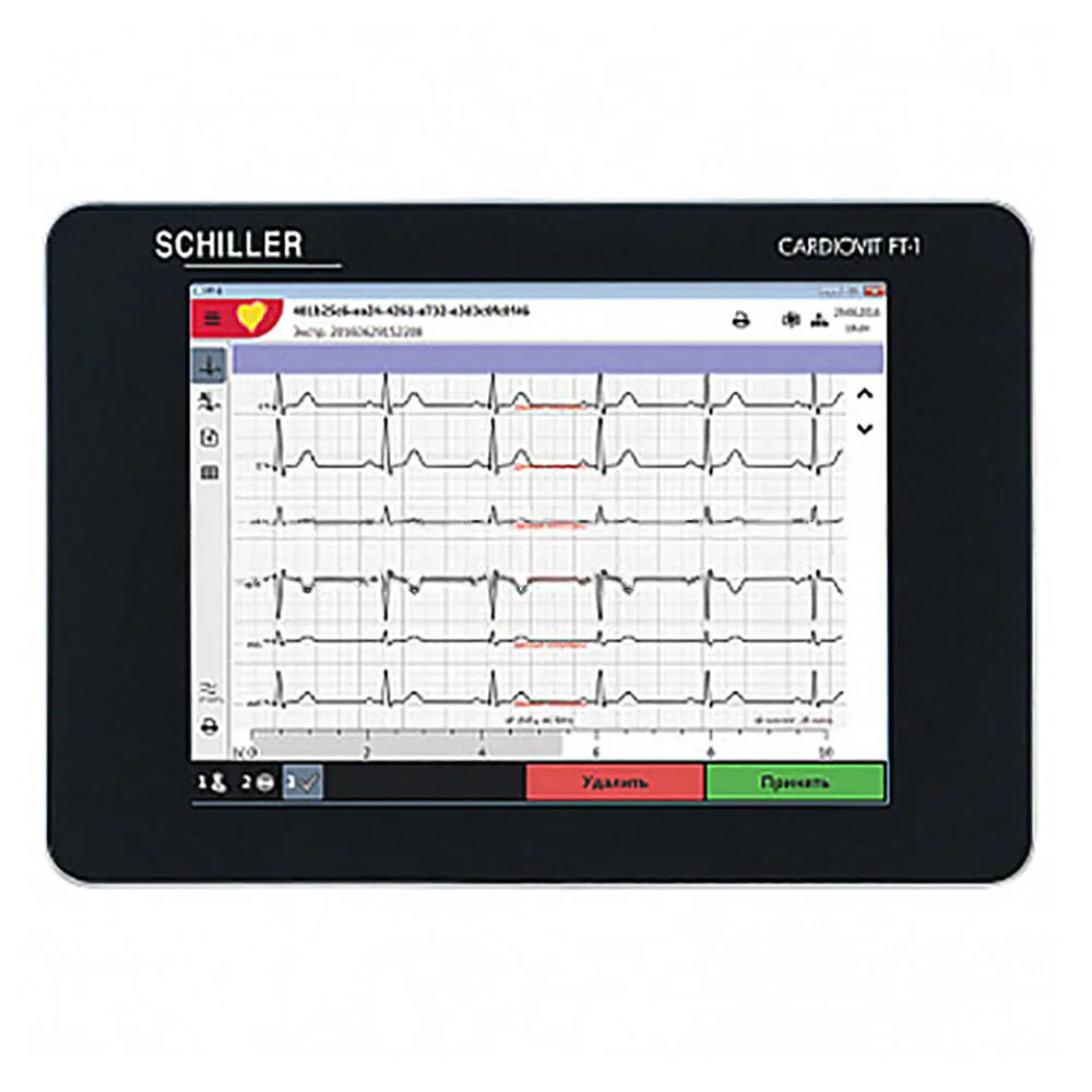 Электрокардиограф SCHILLER CARDIOVIT FT-1, фото 3