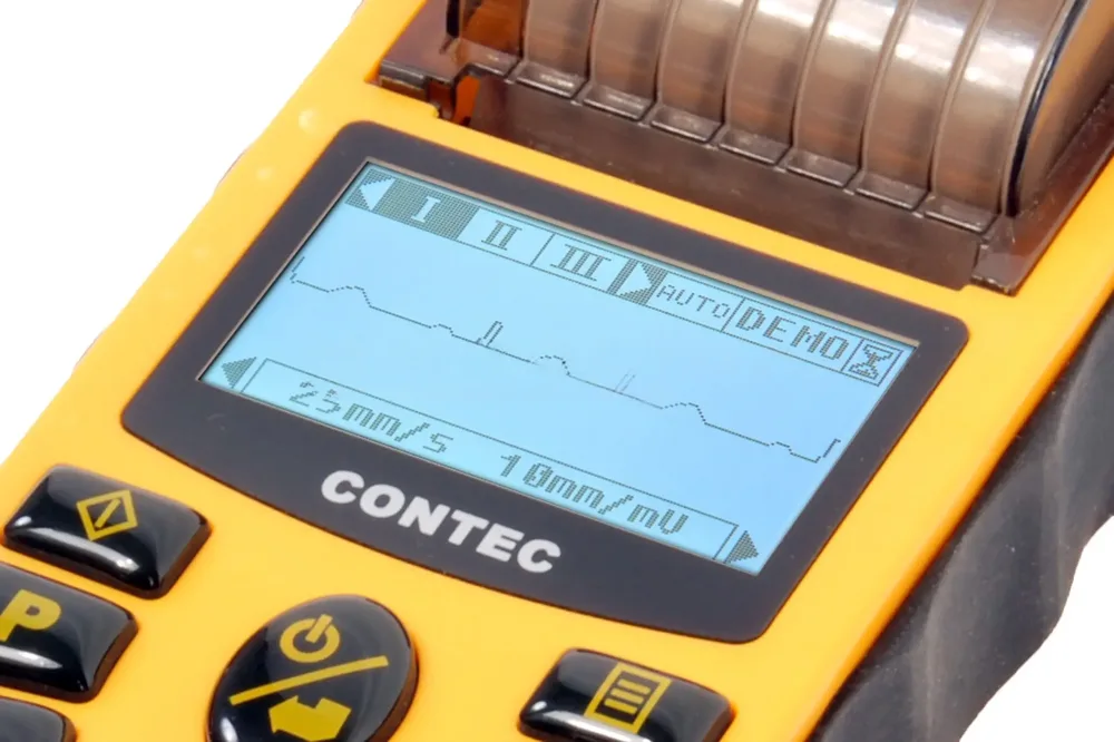 Электрокардиограф Contec ECG80A, фото 3