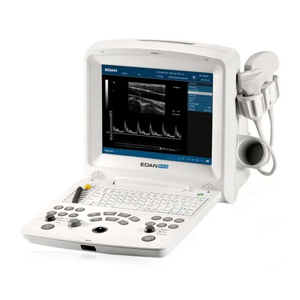 Аппарат УЗИ Edan Dus 60, фото 1