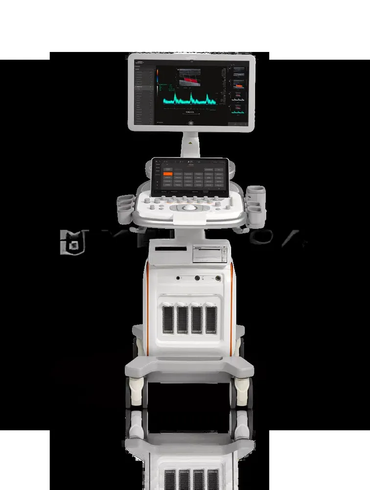 Ультразвуковая система Siemens ACUSON Redwood, фото 2
