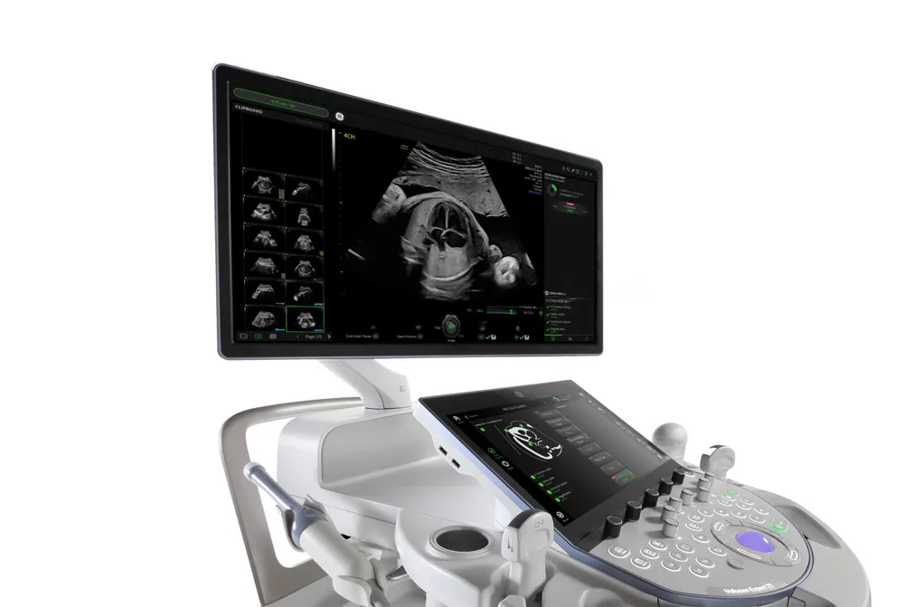 УЗИ аппарат GE HealthCare Voluson Expert 22, фото 3