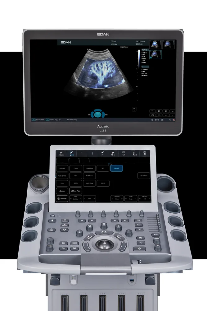 Ультразвуковая система Edan Acclarix LX85, фото 3