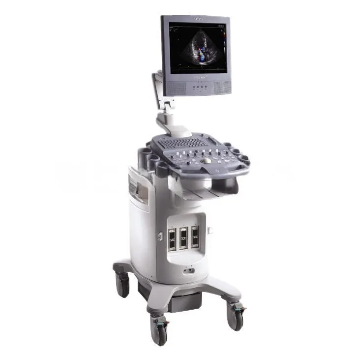 Ультразвуковая система Siemens ACUSON X300 Premium Edition, фото 2