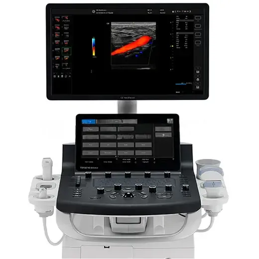 УЗИ аппарат GE Healthcare Versana Balance R2, фото 2