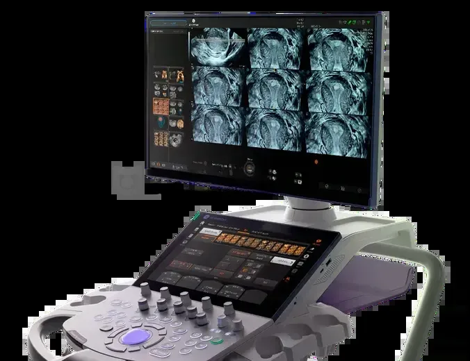УЗИ аппарат GE HealthCare Voluson Signature 18, фото 2