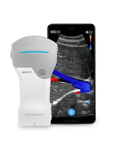 УЗИ аппарат GE HealthCare Vscan Air, фото 1