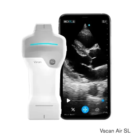 УЗИ аппарат GE HealthCare Vscan Air, фото 2