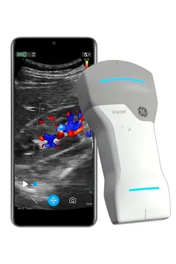 УЗИ аппарат GE HealthCare Vscan Air, фото 3