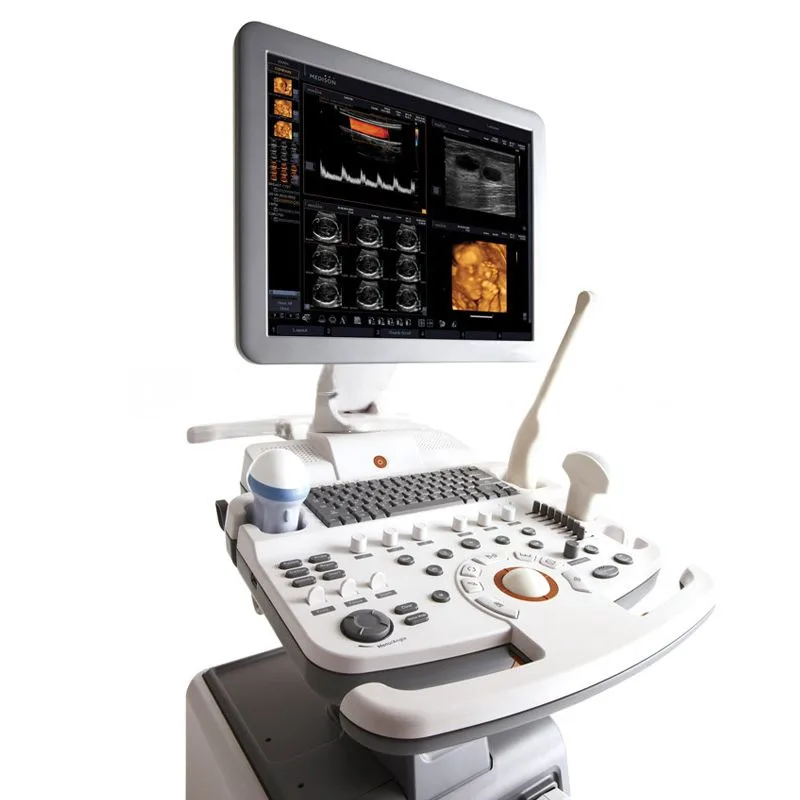 УЗИ аппарат Samsung SonoAce R7, фото 2