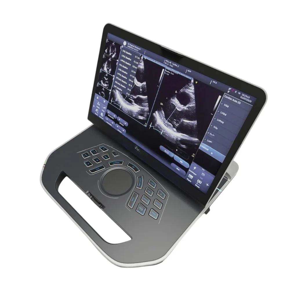Портативная ультразвуковая система GE Healthcare Vivid iQ, фото 1