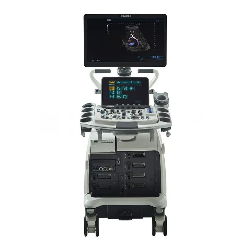 УЗИ аппараты Ультразвуковой аппарат Fujifilm (Hitachi) Arietta 850, фото 1