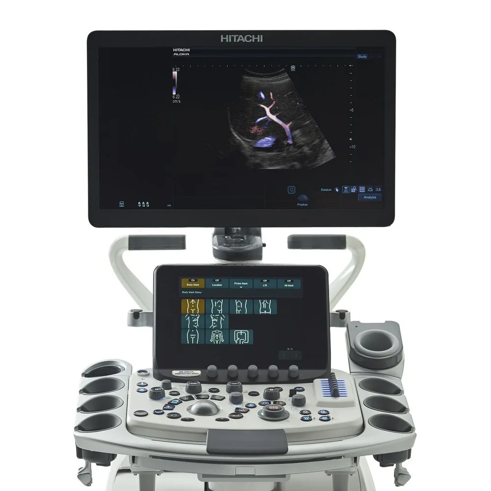 УЗИ аппараты Ультразвуковой аппарат Fujifilm (Hitachi) Arietta 850, фото 3