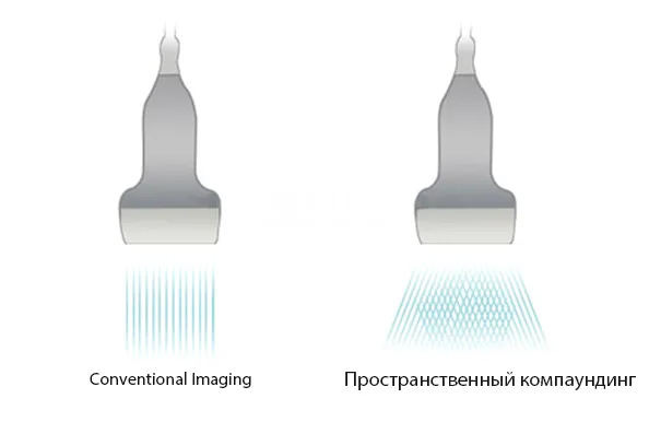 iBeam.jpg?1649741148366