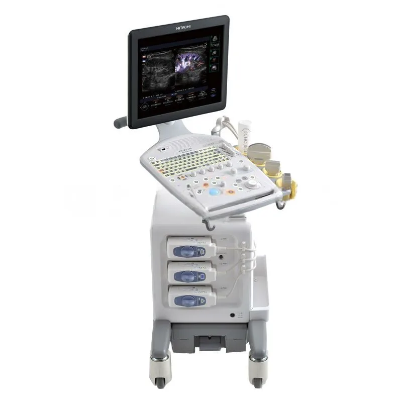Ультразвуковой аппарат Hitachi Aloka ProSound F37, фото 2